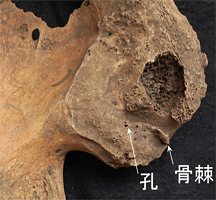 図1　縄文人骨の腸骨耳状面。骨棘や孔が認められる。加齢しつつある個体である。