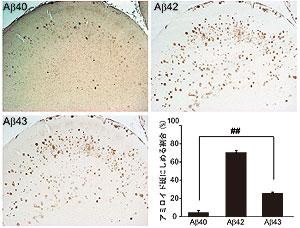 図１　アルツハイマー病患者の脳内に蓄積するAβ種の存在比率