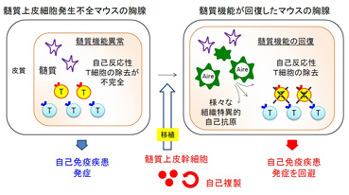 ｔ細胞の中枢性自己寛容を維持する胸腺髄質上皮幹細胞の同定